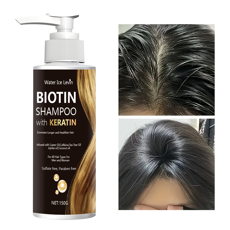 Water Ice Levin Biotin & Kerat – обзор и цена Biotin Hair Growth